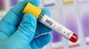 tratamiento hiv